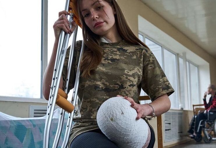 Потерявшая ногу военная ВСУ: “Врач плакал, когда меня оперировал” ➤ Prozoro.net.ua