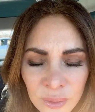 Колола ботокс 20 лет: женщина показала, что будет, если перестать