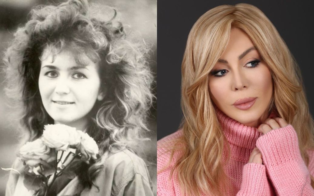 Операцій було багато: як виглядала Ірина Білик до та після пластики ➤ Prozoro.net.ua