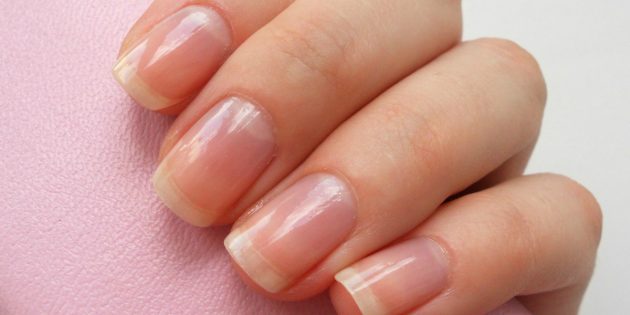 Симптоми на нігтях, які вказують на значні проблеми
