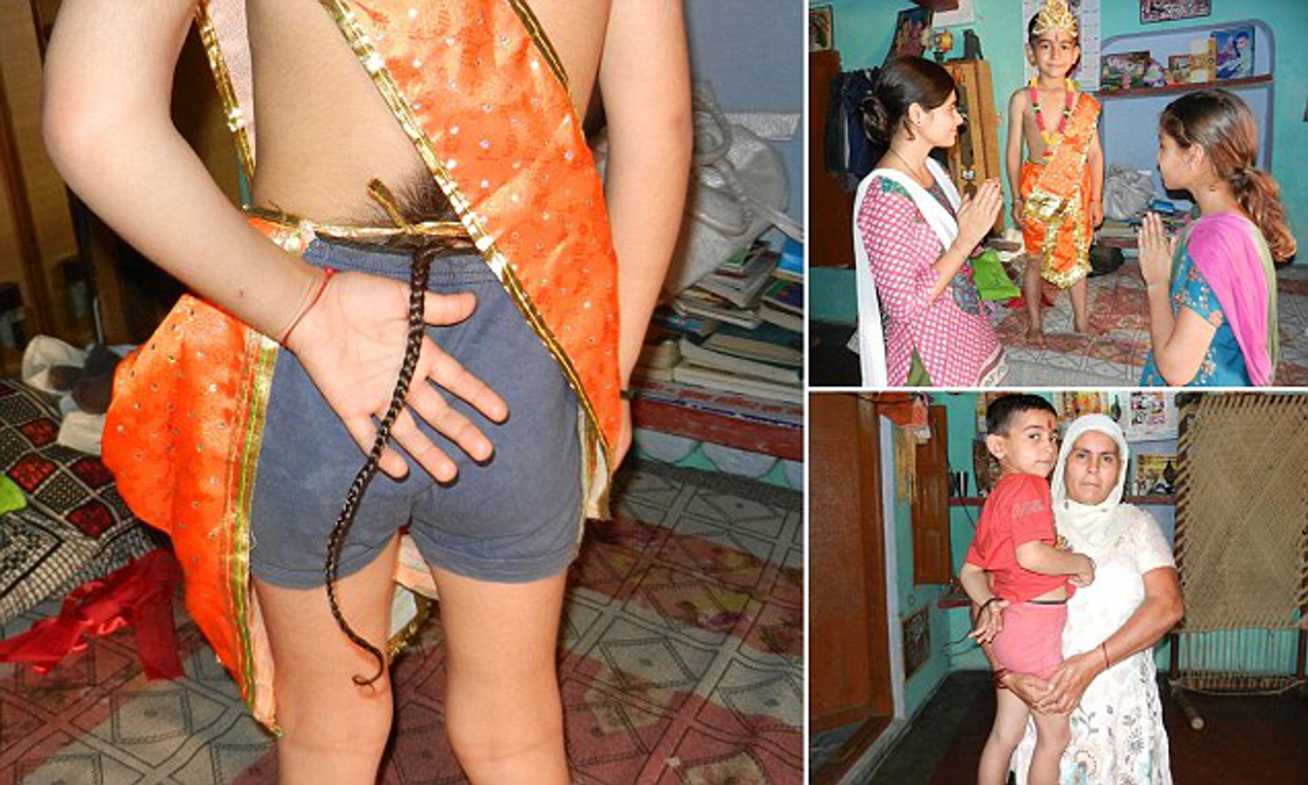 В Індії у хлопця виріс 60-сантиметровий хвіст: фото ➤ Prozoro.net.ua