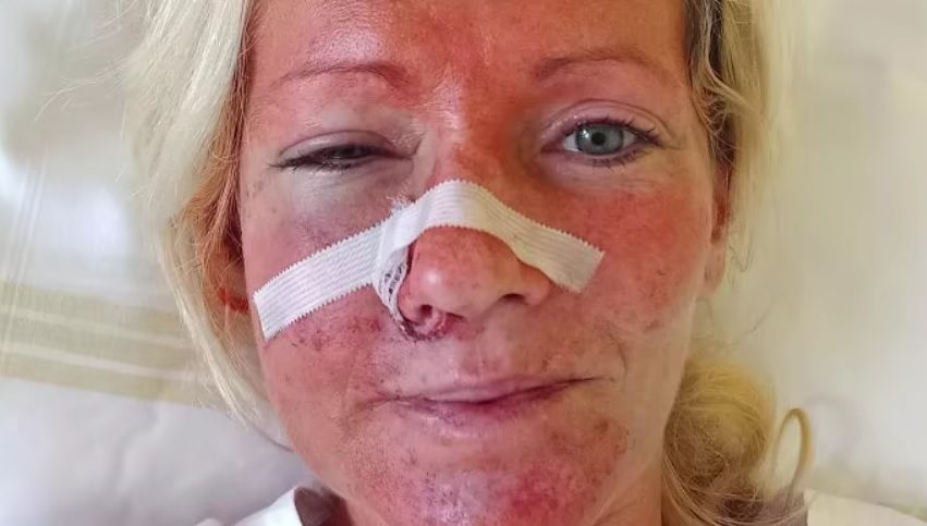 У Чехії чоловік жорстоко побив жінок з України 2 У Чехії чоловік жорстоко побив жінок з України