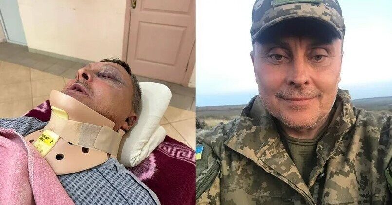 Избиение военного на Одесчине: известна причина нападения ➤ Prozoro.net.ua