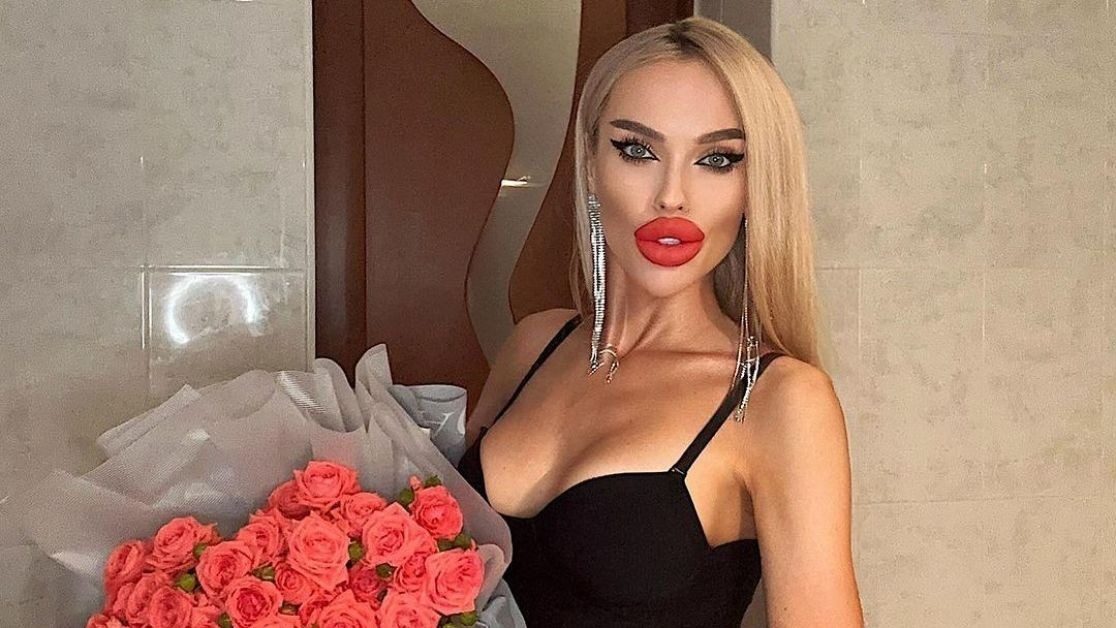 «Королева ДНР» объяснила, почему у нее такие большие губы
