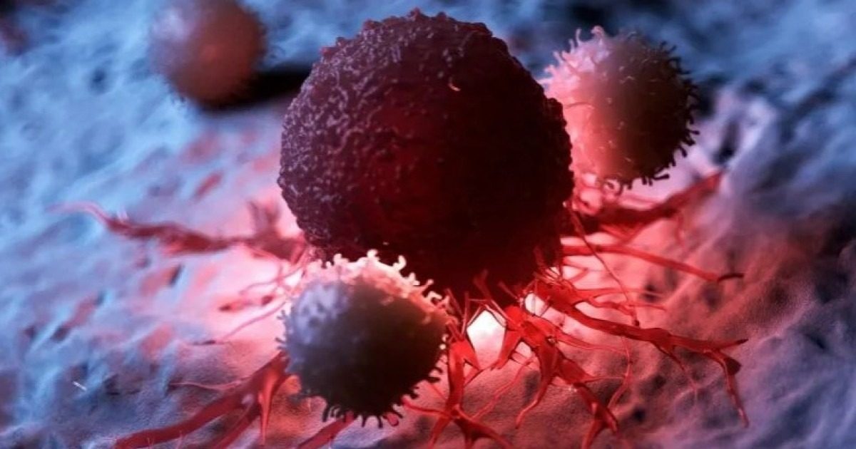 Удалось уничтожить 99% раковых клеток: испытан новый метод