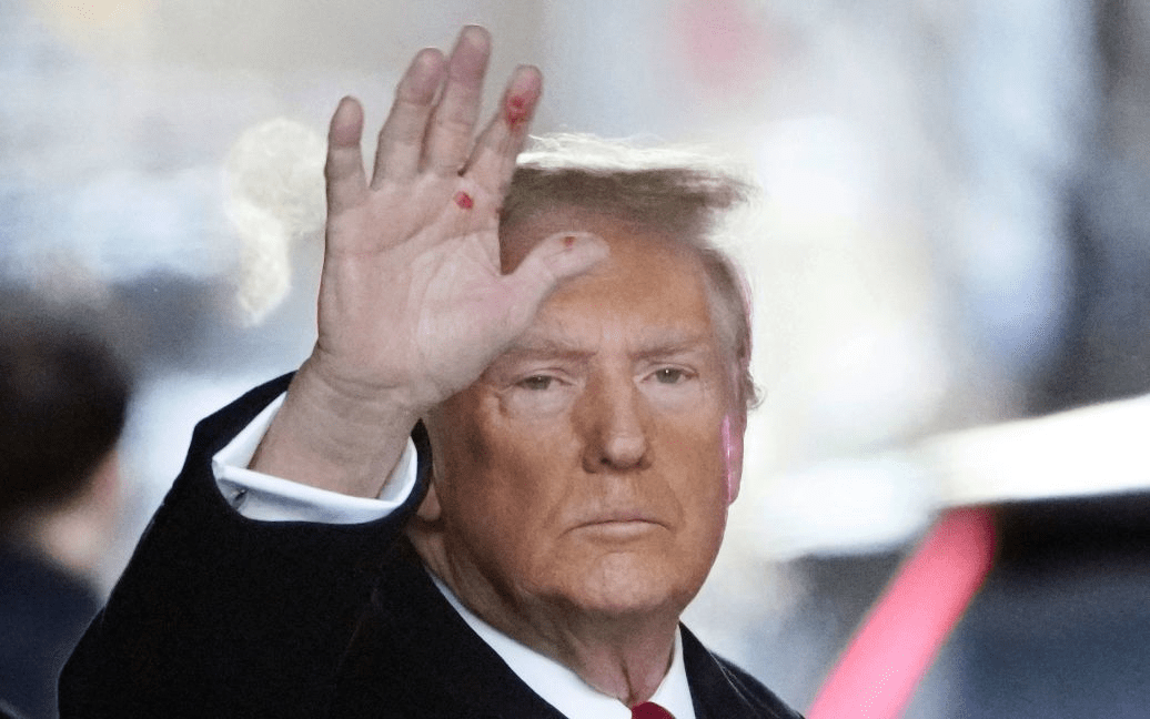 На руці Трампа з’явилися загадкові червоні плями: користувачі Мережі вже поставили кілька “діагнозів” ➤ Prozoro.net.ua