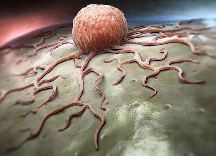 Ученые раскрыли, что вызывает у людей раковые опухоли ➤ Prozoro.net.ua