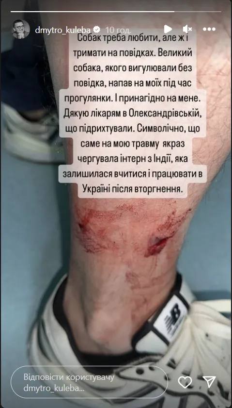Міністра Кулебу у Києві покусав собака: фото 2 Міністра Кулебу у Києві покусав собака: фото