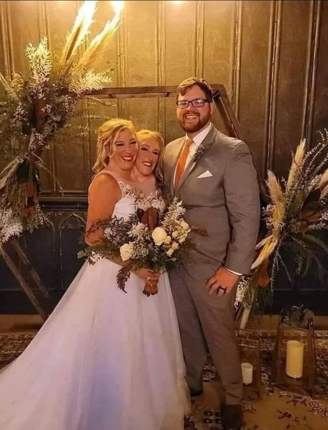 Сіамська близнючка вийшла заміж за ветерана армії – фото, відео
