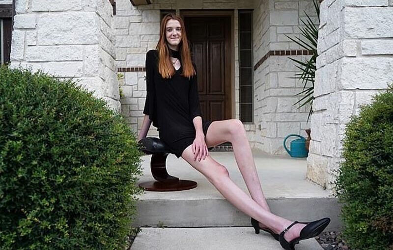 Как выглядит девушка с самыми длинными ногами в мире (видео) ➤ Prozoro.net.ua