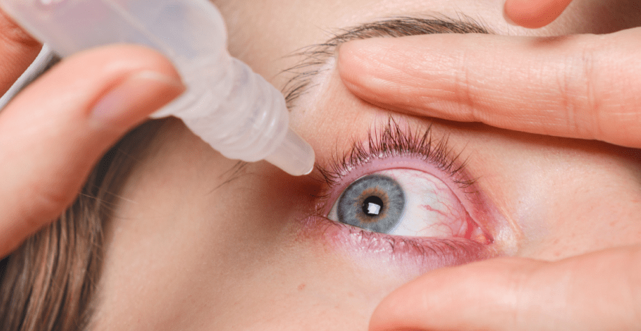 Ознаки синдрому сухого ока: їх в жодному разі не можна ігнорувати ➤ Prozoro.net.ua