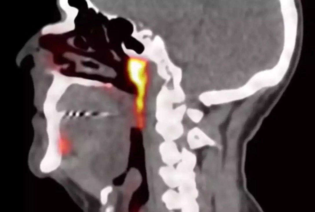 Вчені виявили у нашому тілі новий тендітний орган (фото)