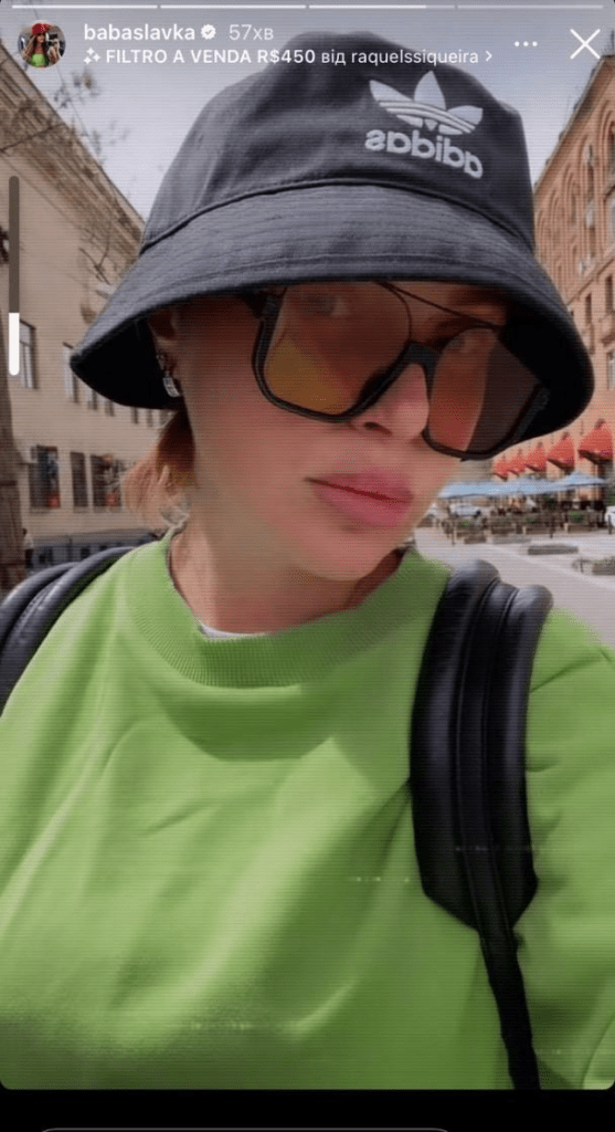 Слава Камінська показала свою зовнішність після нових пластичних операцій