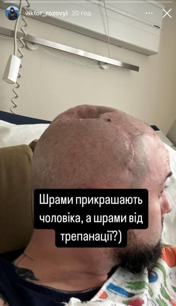 Віктор Розовий, який отримав поранення на фронті, показав наслідки трепанації черепа 2 Віктор Розовий, який отримав поранення на фронті, показав наслідки трепанації черепа
