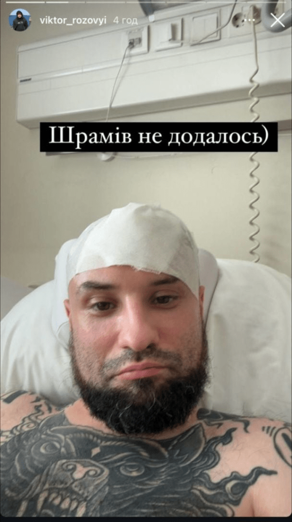 Зірці "Ліги сміху" вставили титанову пластину в череп: як виглядає його травма