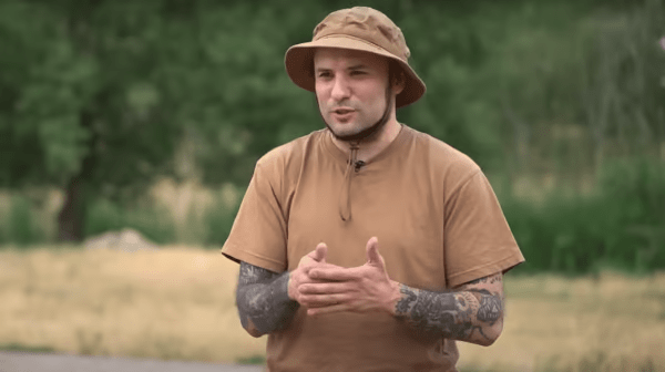 Зірці “Ліги сміху” вставили титанову пластину в череп: як виглядає його травма