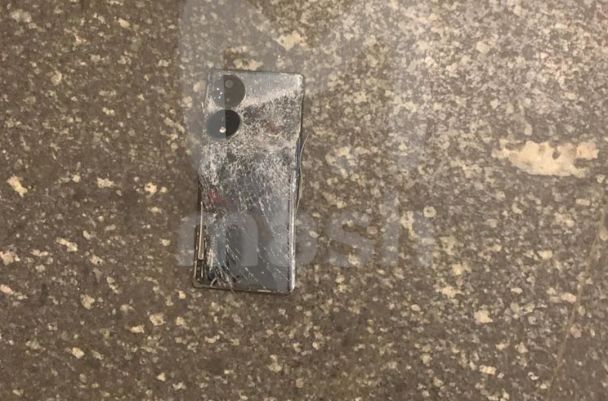 У Москві під час атаки на Хезболлу в руках чоловіка вибухнув ґаджет 3 У Москві під час атаки на Хезболлу в руках чоловіка вибухнув ґаджет