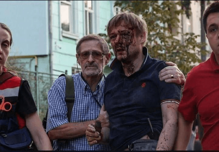 Як зараз живе Ярослав Базилевич, який втратив усю родину внаслідок ракетного удару у Львові