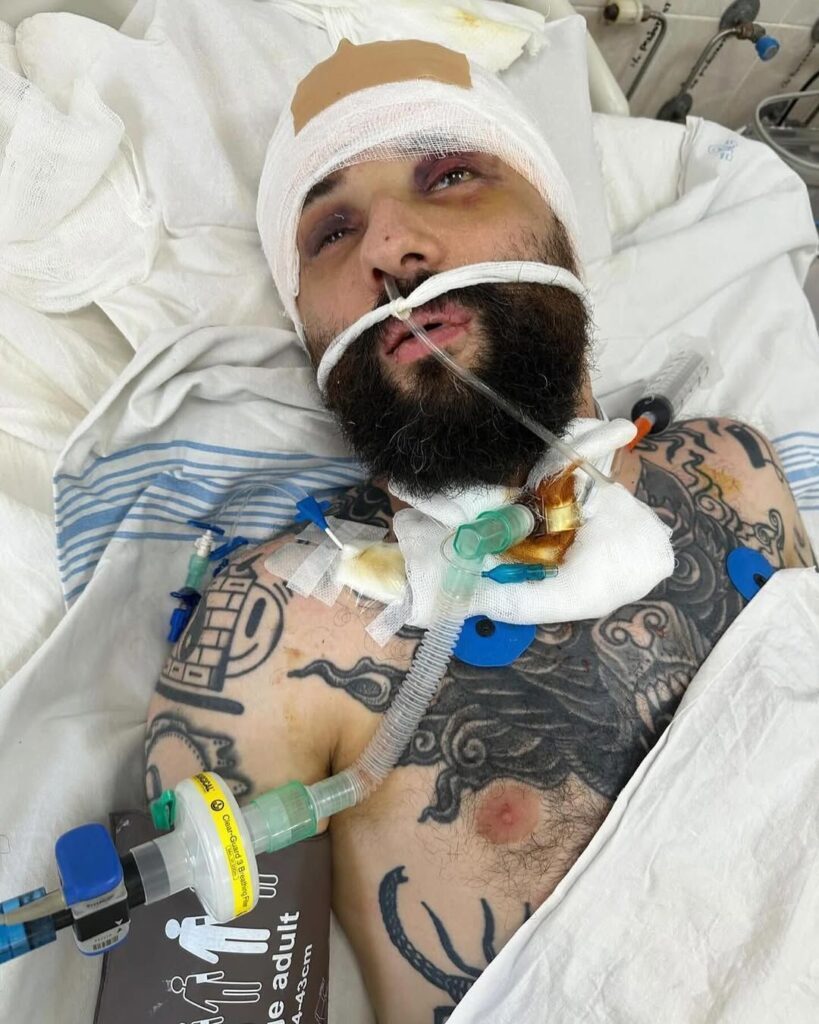 Зірка "Ліги сміху" Розовий вперше розповів про поранення під Авдіївкою і шокував фото 3 Зірка "Ліги сміху" Розовий вперше розповів про поранення під Авдіївкою і шокував фото