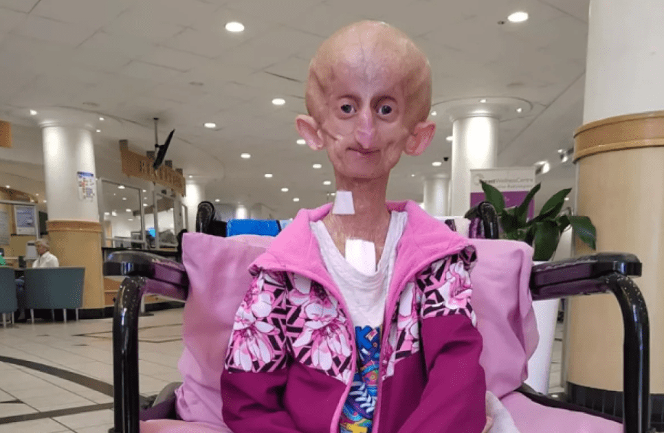 Померла унікальна блогерка, яка старіла у вісім разів швидше