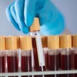Обладатели какой группы крови наиболее подвержены деменции ➤ Prozoro.net.ua