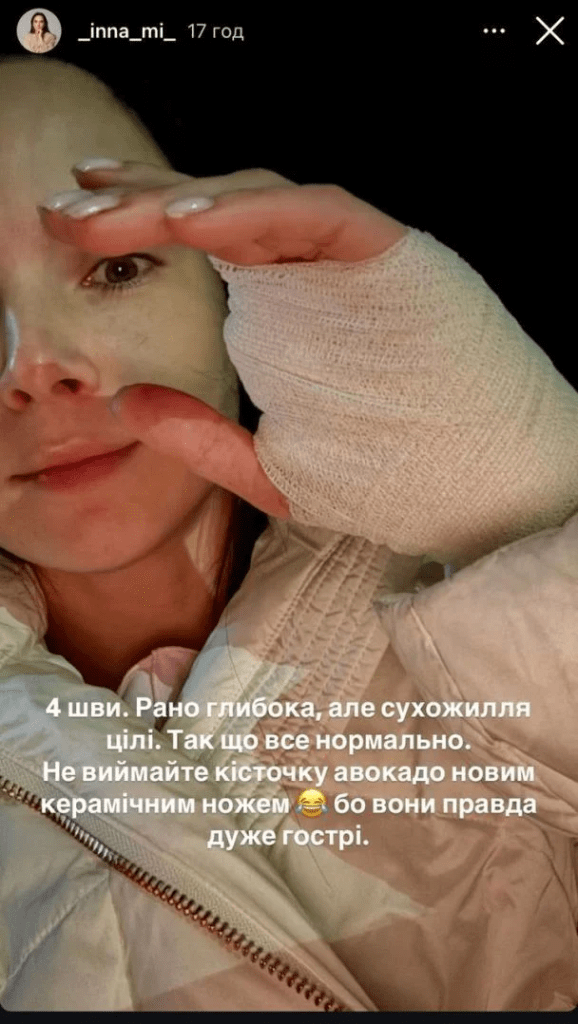 Серйозний інцидент у родині Мірошниченка: дружина потрапила до лікарні через травму