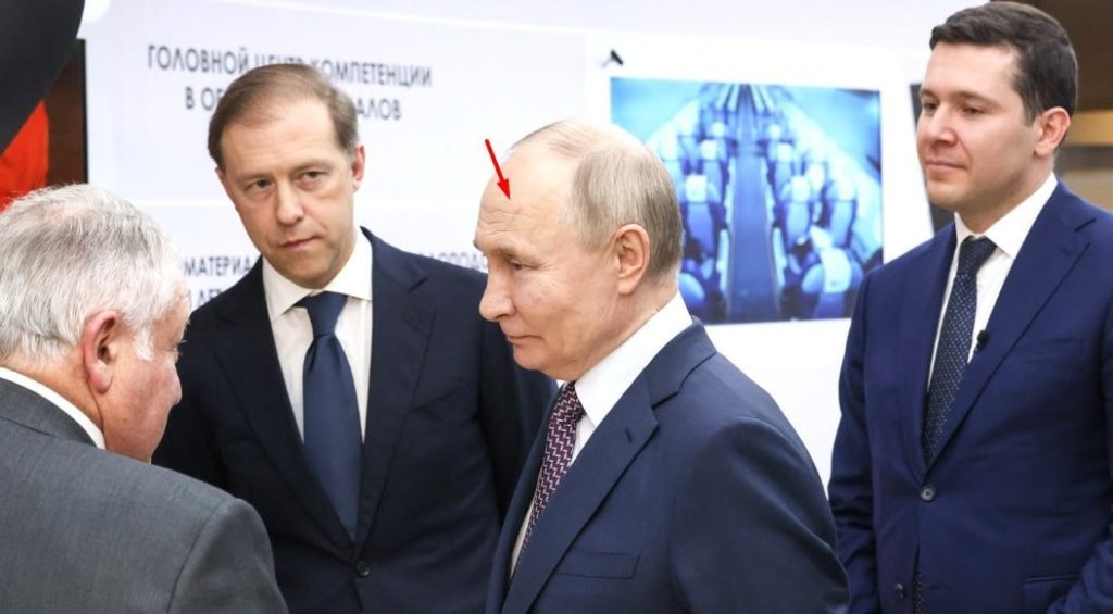 На самому видному місці: у Путіна з'явився свіжий шрам 3 На самому видному місці: у Путіна з'явився свіжий шрам