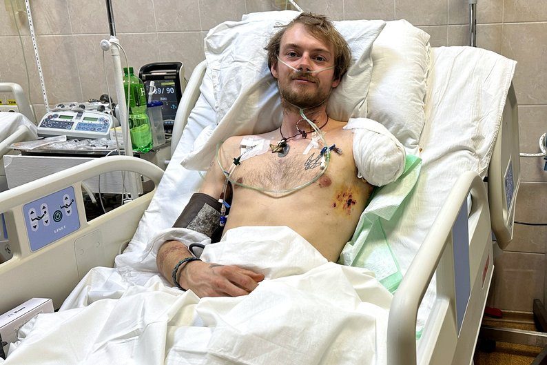Британець втратив руку та ногу на війні в Україні: все одно хоче лишитися тут