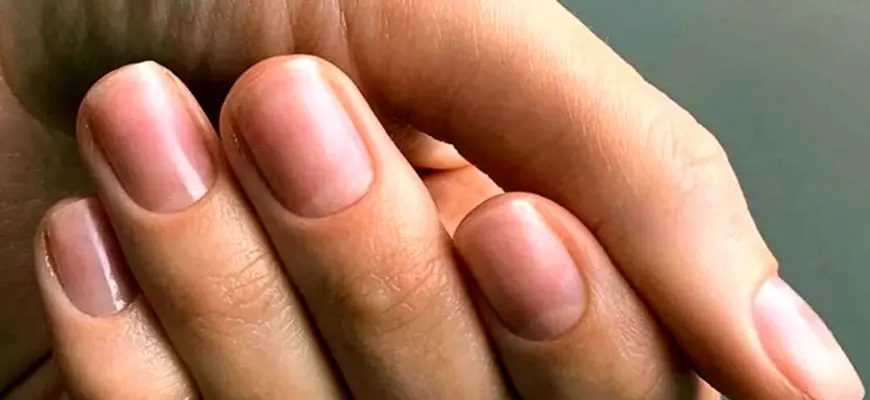 Як нігті показують скільки ви проживете: відповідь генетика