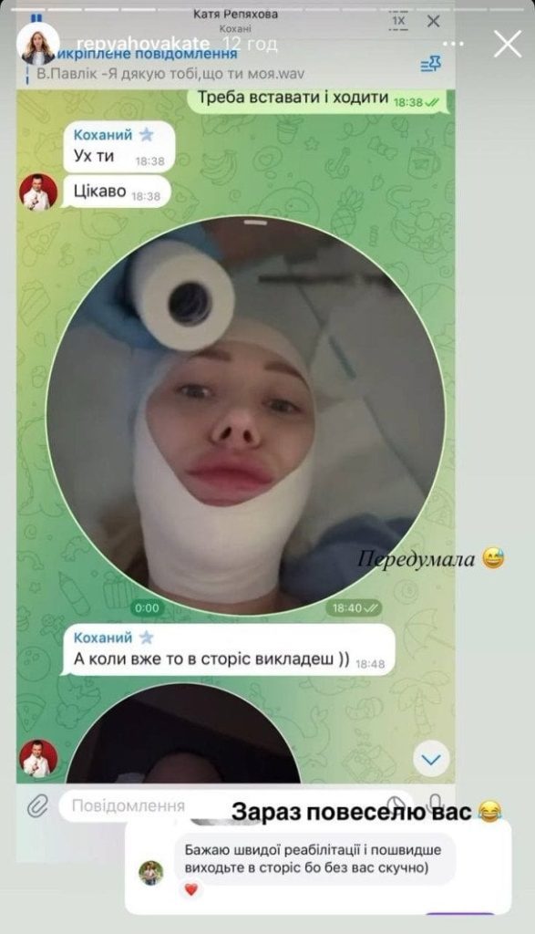 Дружина Віктора Павліка лягла під ніж хірурга: як виглядає блогерка 3 Дружина Віктора Павліка лягла під ніж хірурга: як виглядає блогерка