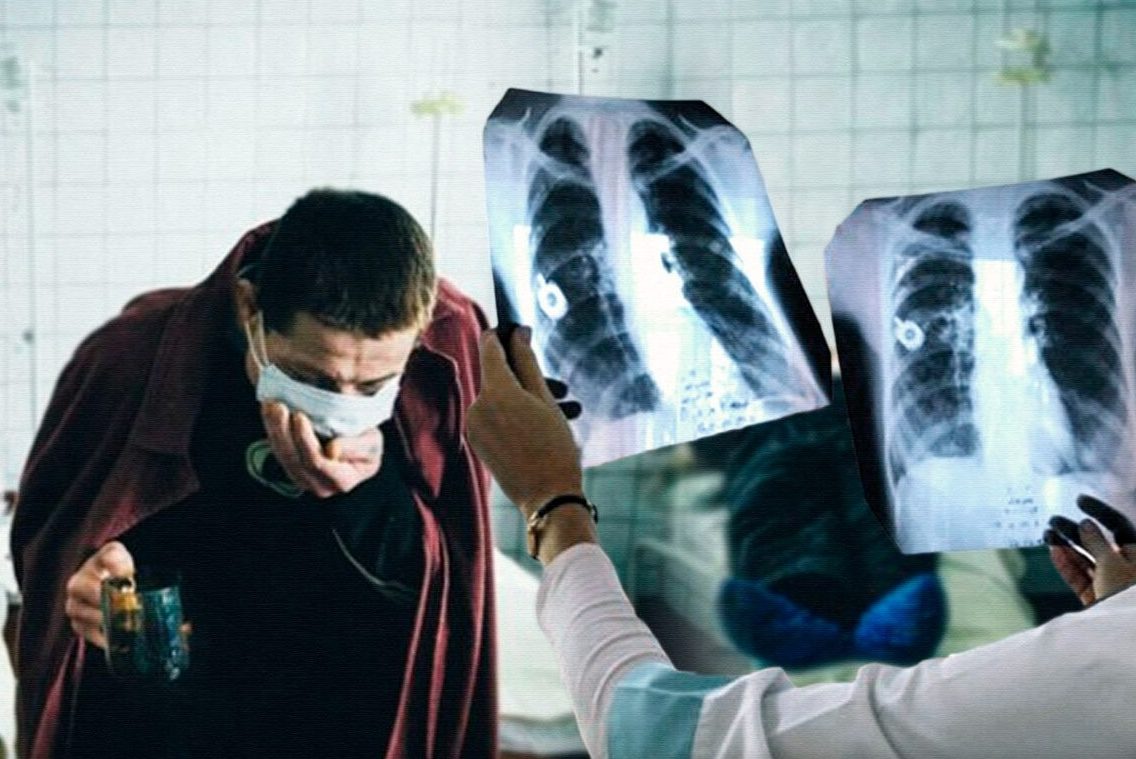 В Украине свирепствует эпидемия опасной болезни: симптомы ➤ Prozoro.net.ua