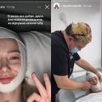 Жена Виктора Павлика легла под нож хирурга: как выглядит блогерша ➤ Prozoro.net.ua
