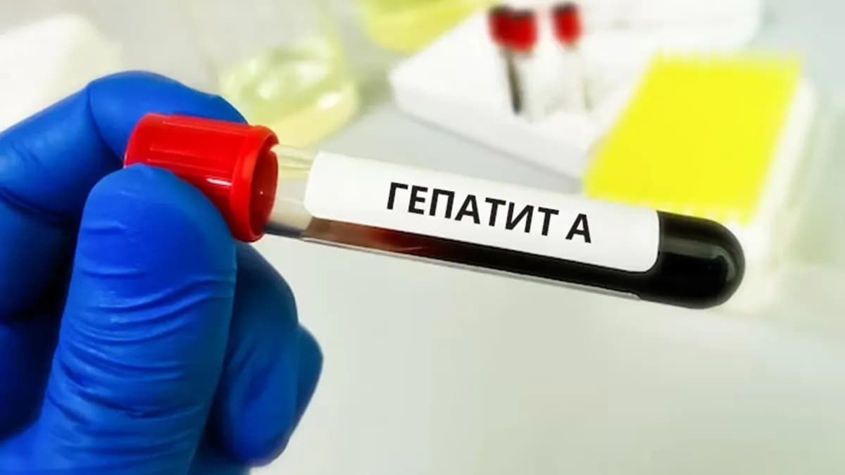 В Киеве – вспышка гепатита А: специалисты обнаружили источник заражения