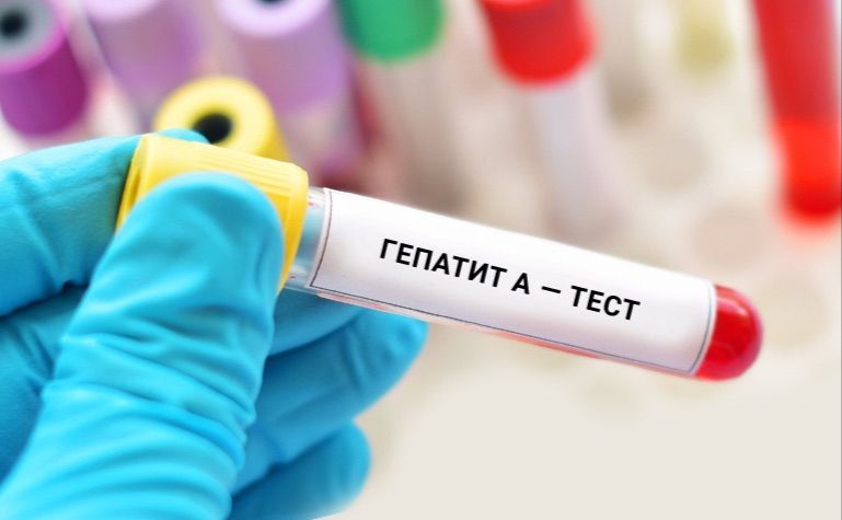 У Києві спалах гепатиту А: десятки інфікованих, закриті школи й перевірки води ➤ Главное.net