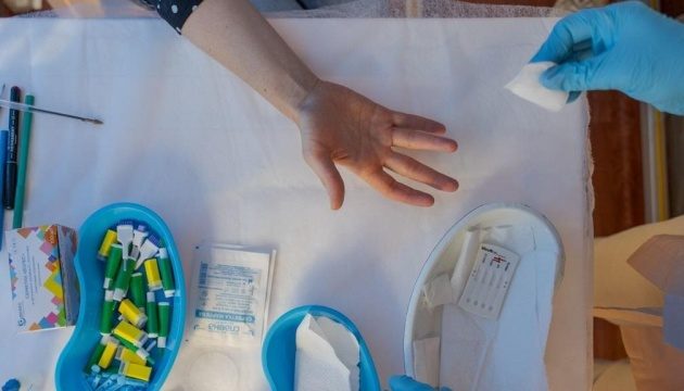 В Киеве вспышка гепатита А: все, что известно