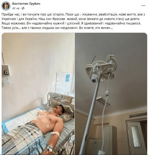 28-летний сын Константина Грубича потерял руку на фронте 4 28-летний сын Константина Грубича потерял руку на фронте
