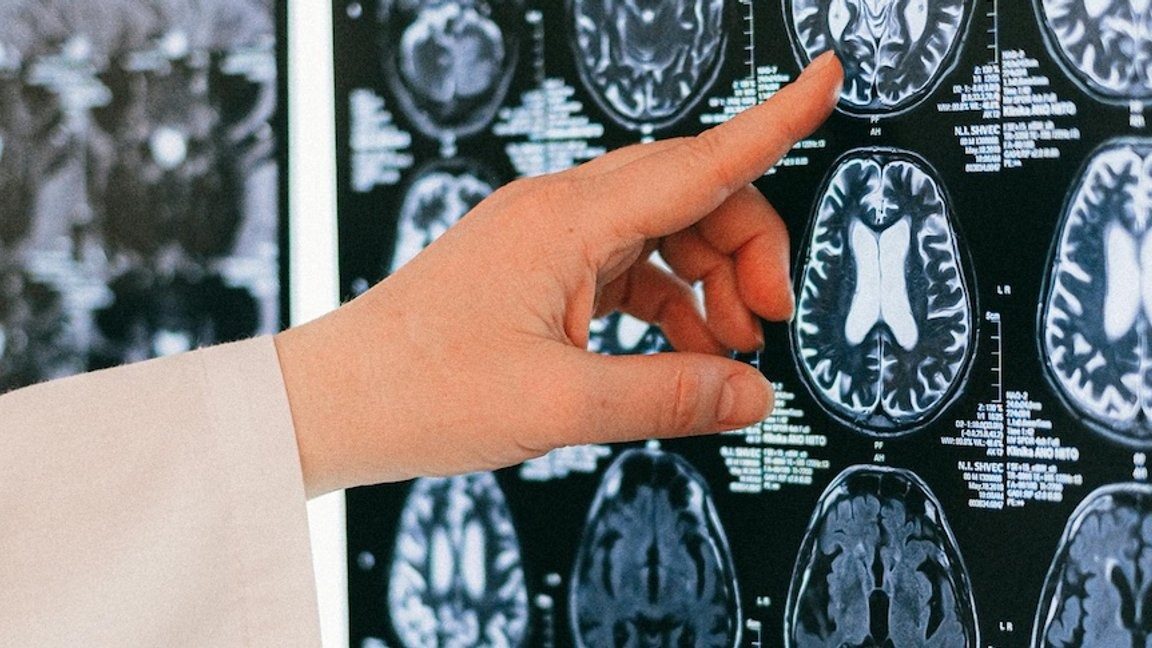 Вчені з’ясували, у якому віці мозок працює найкраще ➤ Главное.net