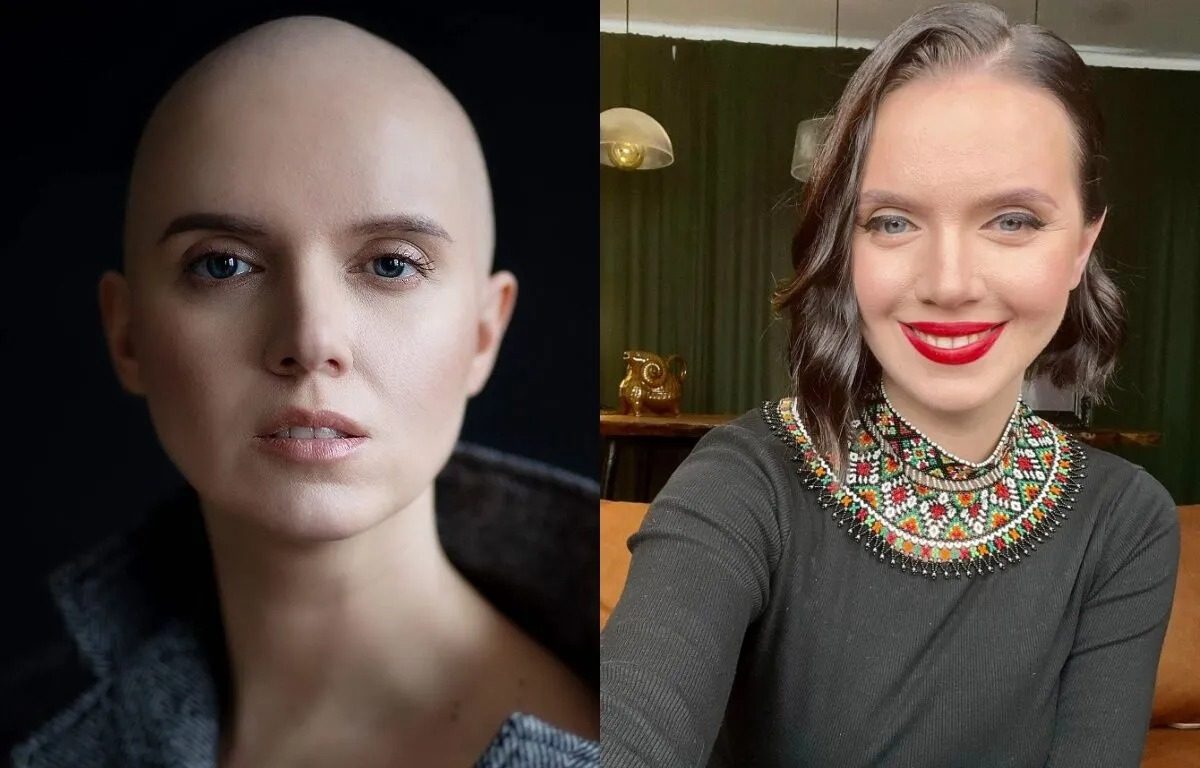 Яніна Соколова про наслідки раку: «Я не є здоровою» ➤ Prozoro.net.ua