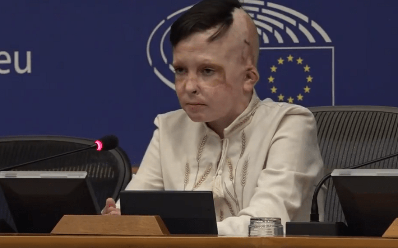 Хлопчик, який вижив під ракетою РФ у Вінниці, зворушив депутатів Європарламенту до сліз (відео) ➤ Prozoro.net.ua