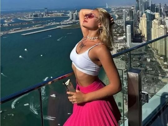 Постраждала в Дубаї Ковальчук здивувала змінами в житті