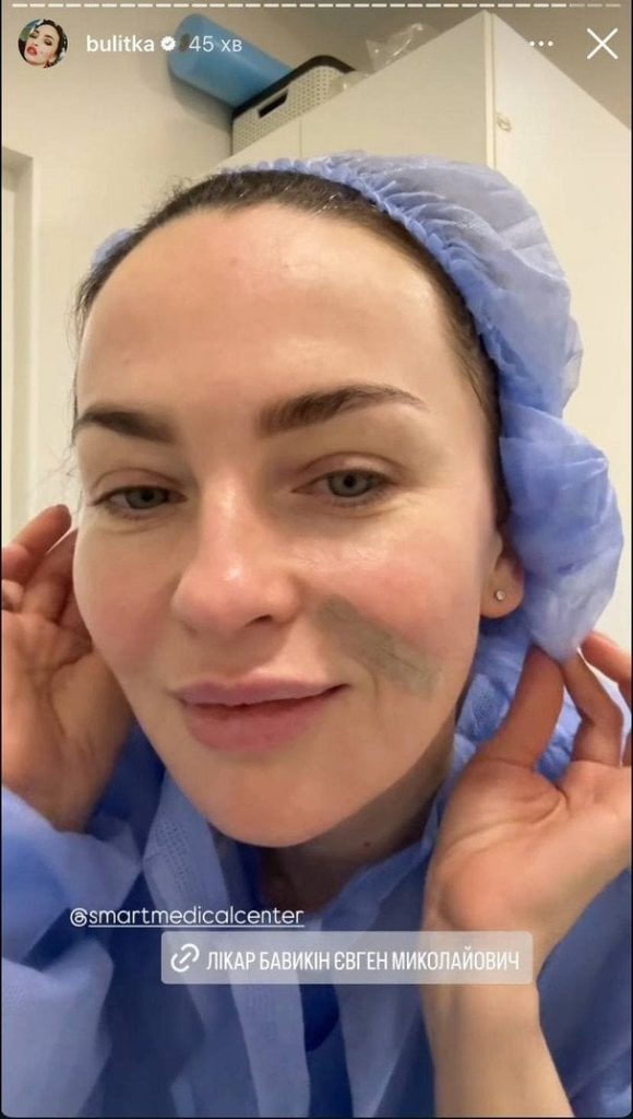 Булитко из "Дизель Шоу" сделала пластику: фото после 3 Булитко из "Дизель Шоу" сделала пластику: фото после