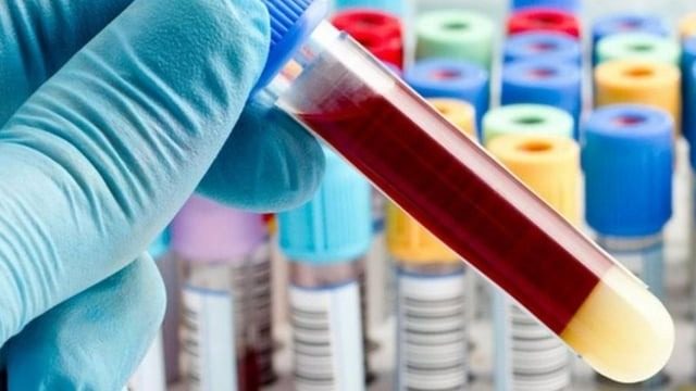 Преимущества и недостатки каждой группы крови: что они означают для здоровья