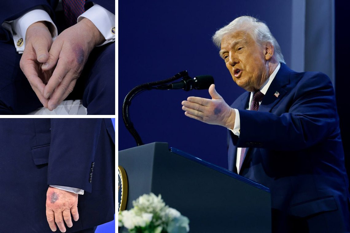 Виступ Трампа викликав нові запитання щодо його здоров’я (фото) ➤ Prozoro.net.ua