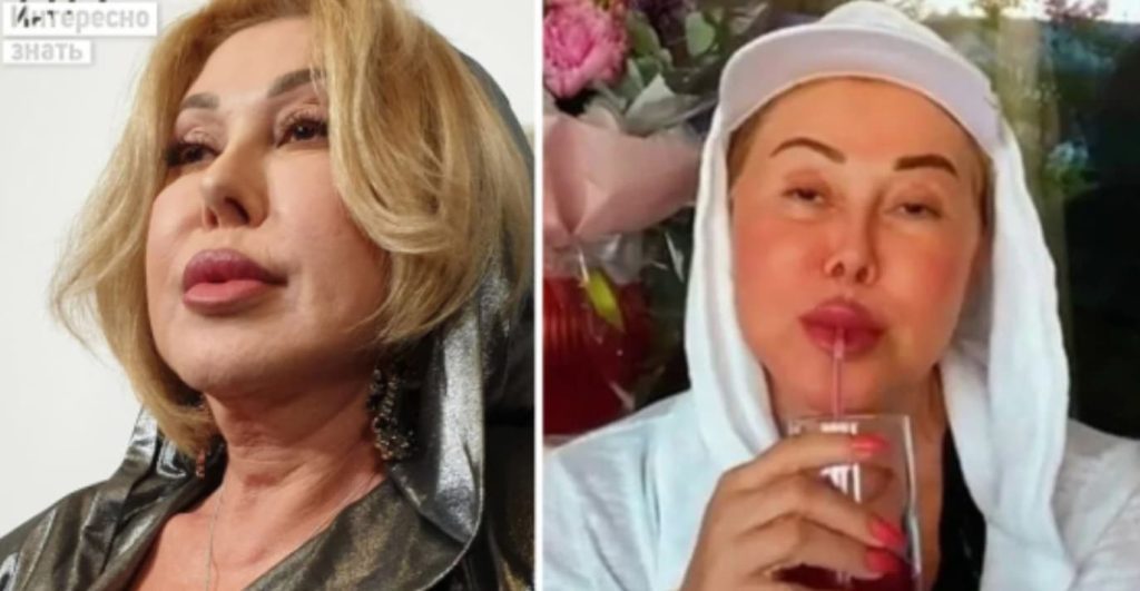 Любов Успенська після пластики спотворила обличчя і стала майже невпізнанною (фото)