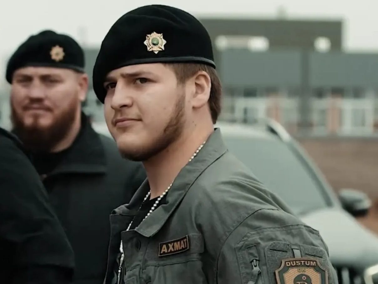 Син Кадирова втратив орган і може осліпнути після ДТП