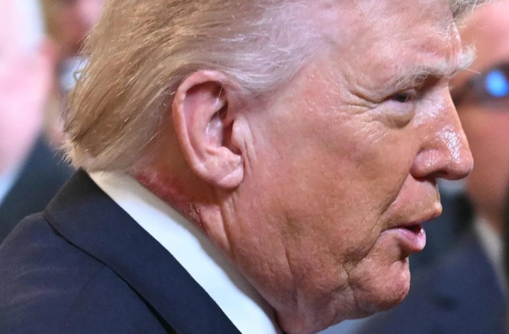 У США знову заговорили про хворобу Трампа через дивні плями на шиї (фото) 4 У США знову заговорили про хворобу Трампа через дивні плями на шиї (фото)