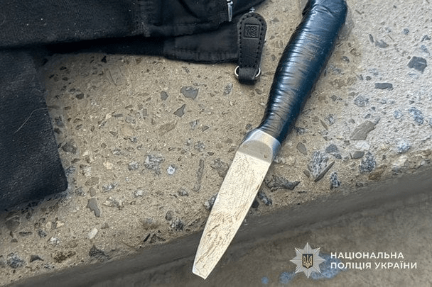 Обломок остался в голове: в Тернополе школьница напала на одноклассницу с ножом 4 Обломок остался в голове: в Тернополе школьница напала на одноклассницу с ножом