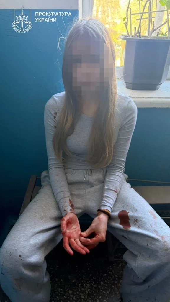 Обломок остался в голове: в Тернополе школьница напала на одноклассницу с ножом 6 Обломок остался в голове: в Тернополе школьница напала на одноклассницу с ножом