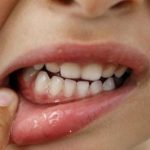 Зуби під загрозою: 10 продуктів, яких варто уникати ➤ Prozoro.net.ua