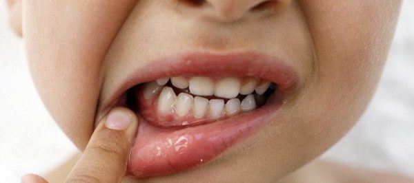 Зуби під загрозою: 10 продуктів, яких варто уникати ➤ Prozoro.net.ua